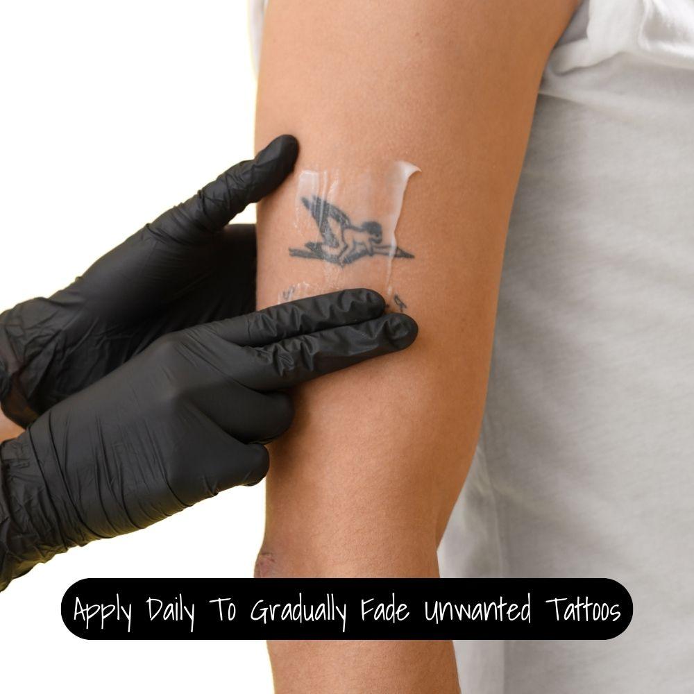 Inkology Tattoo Removal Cream - Inkology-USA